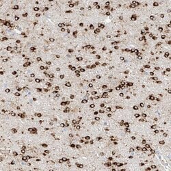Invitrogen MAP7 Polyclonal Antibody 100 &mu;L; Unconjugated:Antibodies,