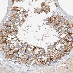 Invitrogen MAP7 Polyclonal Antibody 100 &mu;L; Unconjugated:Antibodies,