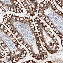 Invitrogen MAP7 Polyclonal Antibody 100 &mu;L; Unconjugated:Antibodies,