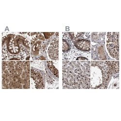 Invitrogen RAD23B Polyclonal Antibody 100 &mu;L | Buy Online | Invitrogen&trade; | Fisher Scientific