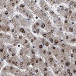 Invitrogen RAD23B Polyclonal Antibody 100 &mu;L | Buy Online | Invitrogen&trade; | Fisher Scientific