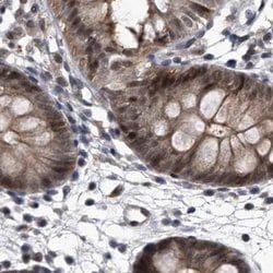 Invitrogen RAD23B Polyclonal Antibody 100 &mu;L | Buy Online | Invitrogen&trade; | Fisher Scientific