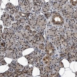 Invitrogen RAD23B Polyclonal Antibody 100 &mu;L | Buy Online | Invitrogen&trade; | Fisher Scientific