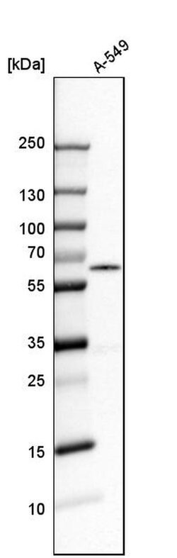 Invitrogen RAD23B Polyclonal Antibody 100 &mu;L | Buy Online | Invitrogen&trade; | Fisher Scientific