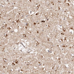Invitrogen BCL2L15 Polyclonal Antibody 100 &mu;L; Unconjugated:Antibodies,