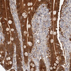 Invitrogen BCL2L15 Polyclonal Antibody 100 μL; Unconjugated:Antibodies,