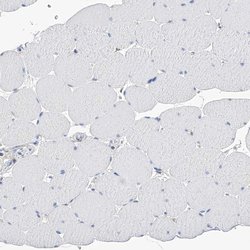 Invitrogen PGM3 Polyclonal Antibody 100 &mu;L; Unconjugated:Antibodies,