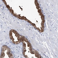 Invitrogen PGM3 Polyclonal Antibody 100 &mu;L; Unconjugated:Antibodies,