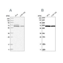 Invitrogen PGM3 Polyclonal Antibody 100 &mu;L; Unconjugated:Antibodies,