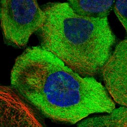 Invitrogen CDV3 Polyclonal Antibody 100 &mu;L; Unconjugated:Antibodies,