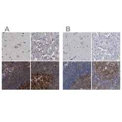 Invitrogen CDV3 Polyclonal Antibody 100 &mu;L; Unconjugated:Antibodies,