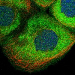 Invitrogen CDV3 Polyclonal Antibody 100 &mu;L; Unconjugated:Antibodies,