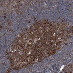 Invitrogen CDV3 Polyclonal Antibody 100 &mu;L; Unconjugated:Antibodies,