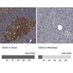 Invitrogen CDV3 Polyclonal Antibody 100 &mu;L; Unconjugated:Antibodies,