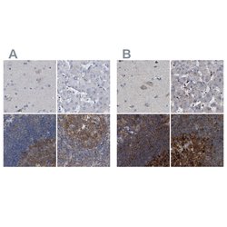 Invitrogen CDV3 Polyclonal Antibody 100 &mu;L; Unconjugated:Antibodies,