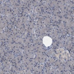 Invitrogen CDV3 Polyclonal Antibody 100 &mu;L; Unconjugated:Antibodies,