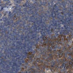 Invitrogen CDV3 Polyclonal Antibody 100 &mu;L; Unconjugated:Antibodies,