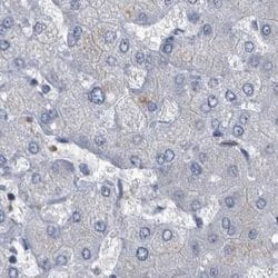 Invitrogen CDV3 Polyclonal Antibody 100 &mu;L; Unconjugated:Antibodies,
