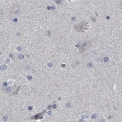 Invitrogen CDV3 Polyclonal Antibody 100 &mu;L; Unconjugated:Antibodies,