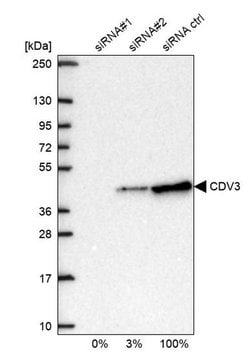 Invitrogen CDV3 Polyclonal Antibody 100 &mu;L; Unconjugated:Antibodies,