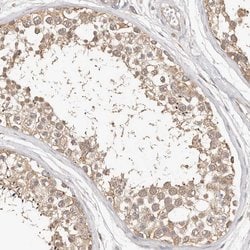 Invitrogen FAM54A Polyclonal Antibody 100 &mu;L; Unconjugated:Antibodies,