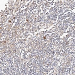 Invitrogen FAM54A Polyclonal Antibody 100 &mu;L; Unconjugated:Antibodies,