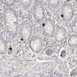 Invitrogen FAM54A Polyclonal Antibody 100 &mu;L; Unconjugated:Antibodies,