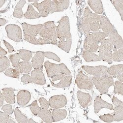 Invitrogen FAM54A Polyclonal Antibody 100 &mu;L; Unconjugated:Antibodies,