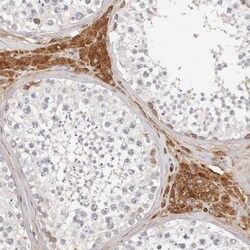 Invitrogen FAM54A Polyclonal Antibody 100 &mu;L; Unconjugated:Antibodies,