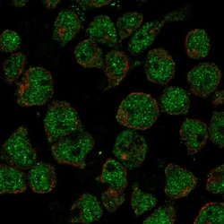 Invitrogen TTC24 Polyclonal Antibody 100 &mu;L; Unconjugated:Antibodies,