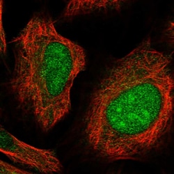 Invitrogen CLDND1 Polyclonal Antibody 100 &mu;L; Unconjugated:Antibodies,