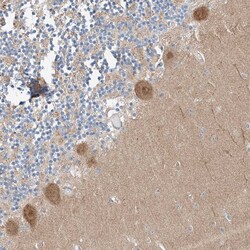 Invitrogen CLDND1 Polyclonal Antibody 100 &mu;L; Unconjugated:Antibodies,