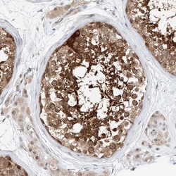 Invitrogen CLDND1 Polyclonal Antibody 100 &mu;L; Unconjugated:Antibodies,