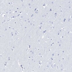 Invitrogen LALBA Polyclonal Antibody 100 &mu;L | Buy Online | Invitrogen&trade; | Fisher Scientific