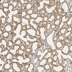 Invitrogen LALBA Polyclonal Antibody 100 &mu;L | Buy Online | Invitrogen&trade; | Fisher Scientific