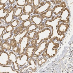 Invitrogen LALBA Polyclonal Antibody 100 &mu;L | Buy Online | Invitrogen&trade; | Fisher Scientific