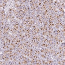 Invitrogen KIAA1324 Polyclonal Antibody 100 &mu;L | Buy Online | Invitrogen&trade; | Fisher Scientific