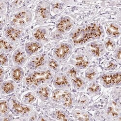 Invitrogen KIAA1324 Polyclonal Antibody 100 &mu;L | Buy Online | Invitrogen&trade; | Fisher Scientific