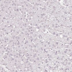 Invitrogen KIAA1324 Polyclonal Antibody 100 &mu;L | Buy Online | Invitrogen&trade; | Fisher Scientific