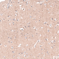 Invitrogen NKAIN4 Polyclonal Antibody 100 &mu;L; Unconjugated:Antibodies,