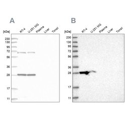 Invitrogen MRPL10 Polyclonal Antibody 100 &mu;L; Unconjugated:Antibodies,