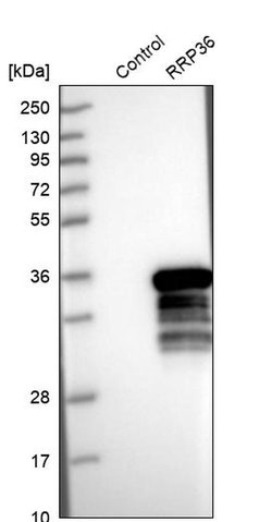 Invitrogen RRP36 Polyclonal Antibody 100 &mu;L; Unconjugated:Antibodies,