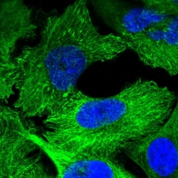 Invitrogen Plectin Polyclonal Antibody 100 &mu;L; Unconjugated:Antibodies,