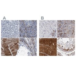 Invitrogen Plectin Polyclonal Antibody 100 &mu;L; Unconjugated:Antibodies,