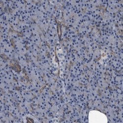 Invitrogen Plectin Polyclonal Antibody 100 &mu;L; Unconjugated:Antibodies,