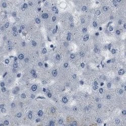 Invitrogen Plectin Polyclonal Antibody 100 &mu;L; Unconjugated:Antibodies,