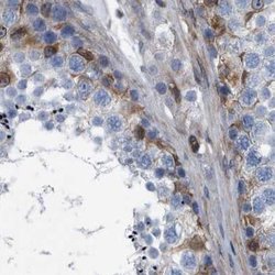 Invitrogen Plectin Polyclonal Antibody 100 &mu;L; Unconjugated:Antibodies,