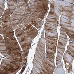 Invitrogen Plectin Polyclonal Antibody 100 &mu;L; Unconjugated:Antibodies,