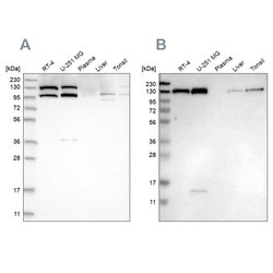 Invitrogen XPO5 Polyclonal Antibody 100 &mu;L; Unconjugated:Antibodies,