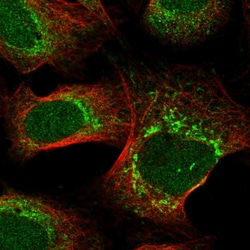Invitrogen COA7 Polyclonal Antibody 100 &mu;L; Unconjugated:Antibodies,